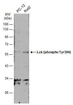 Phospho-LCK (Tyr394) Antibody (PA5-78038)