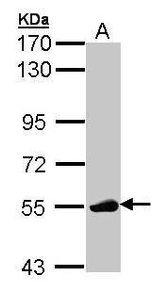 LCK Antibody (PA5-78039)