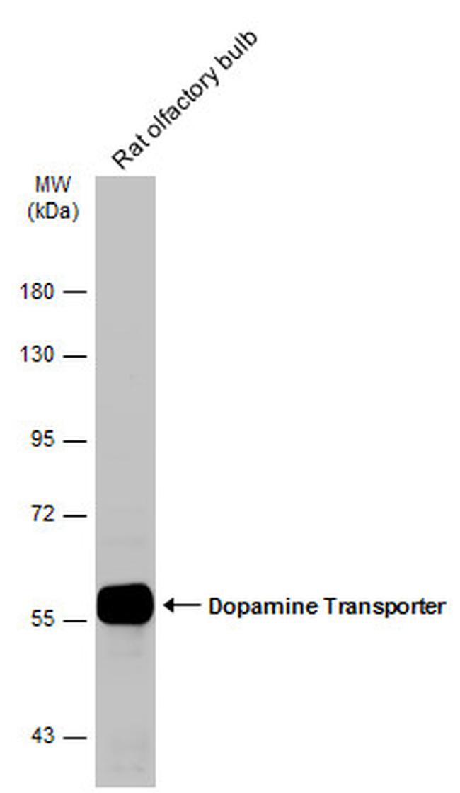 Dopamine Transporter Antibody (PA5-78382)