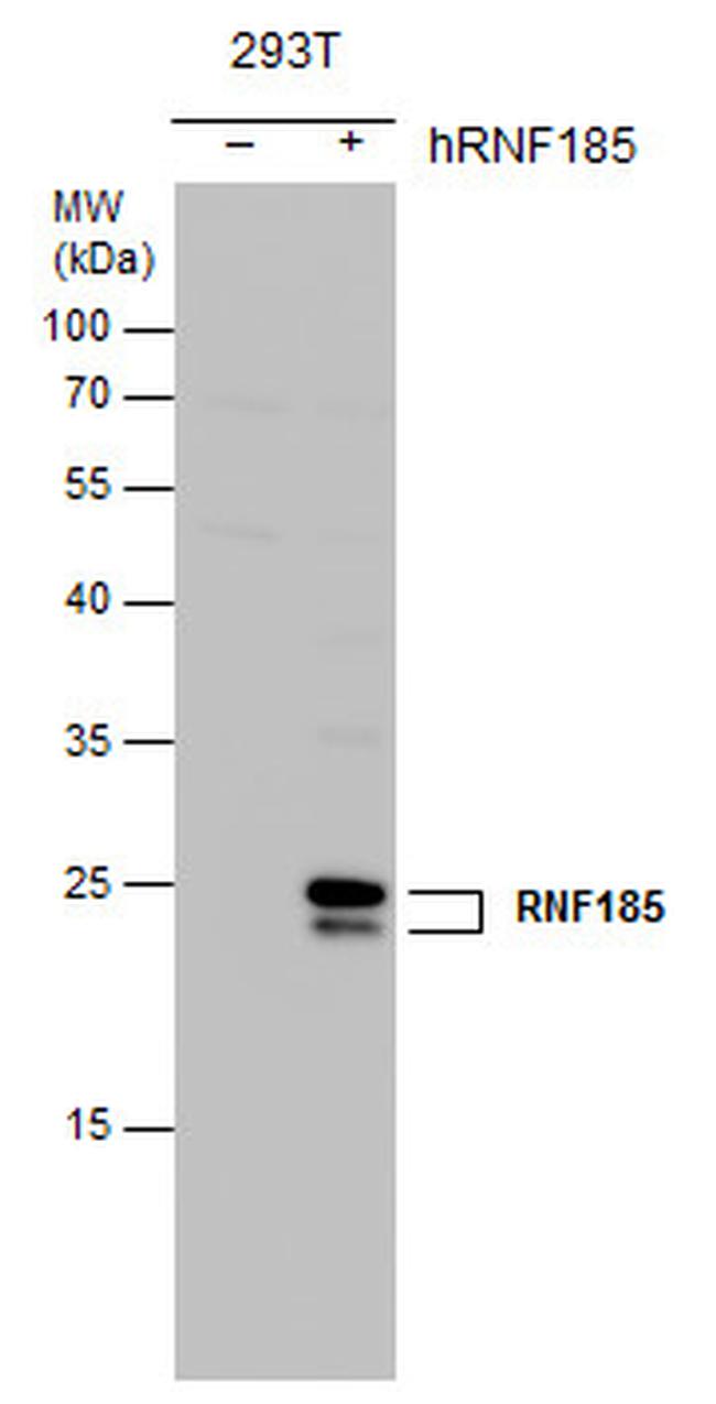 RNF185 Antibody (PA5-78615)