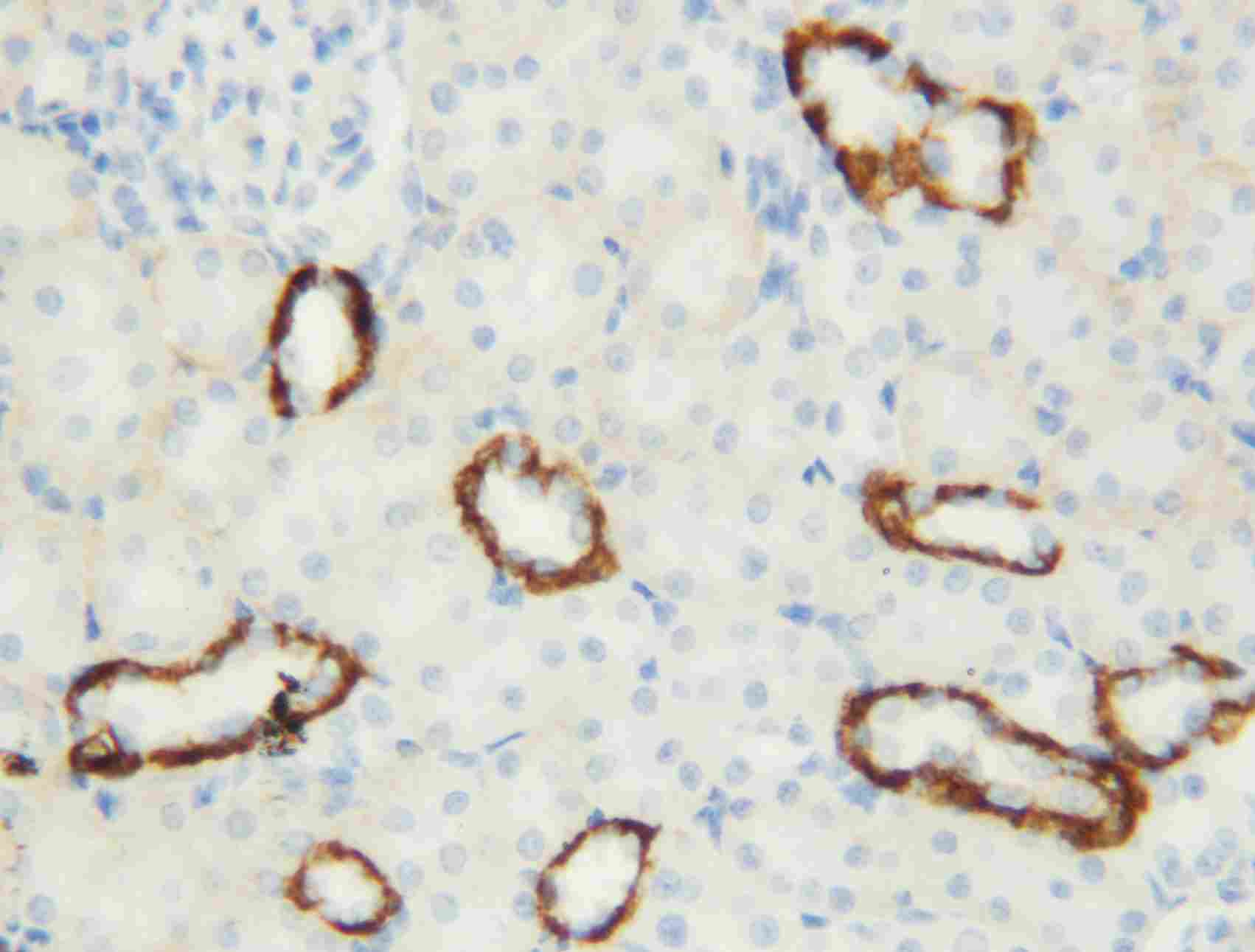 Aquaporin 3 Antibody (PA5-78811)