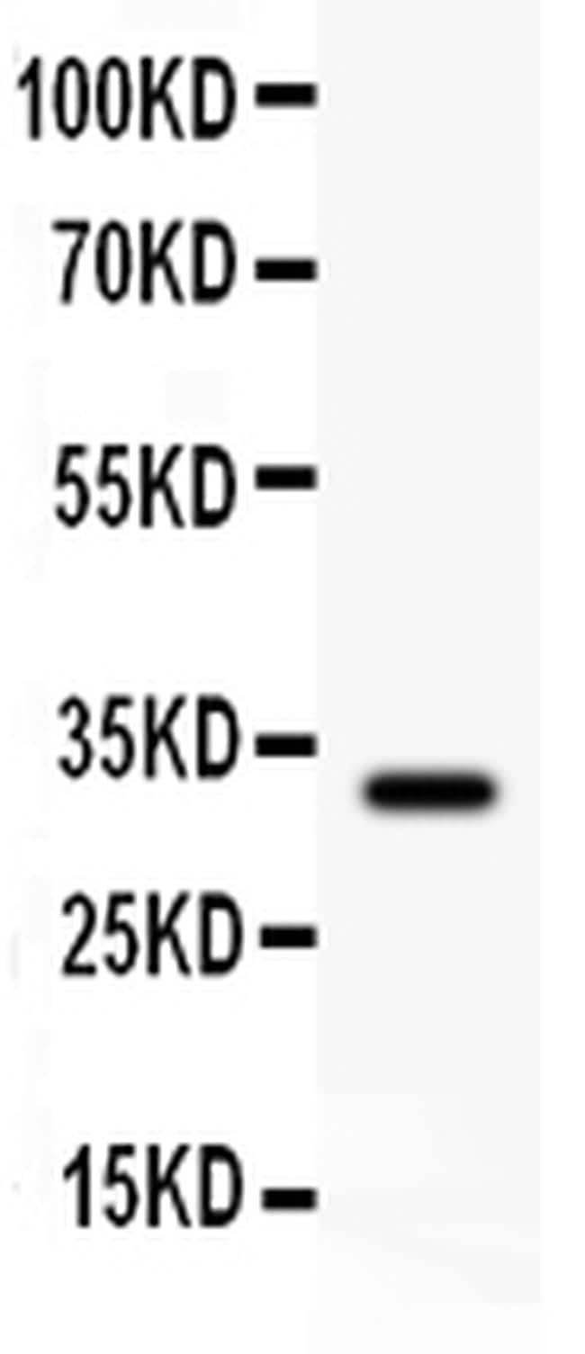 his tagged dhfr from e coli western blot results