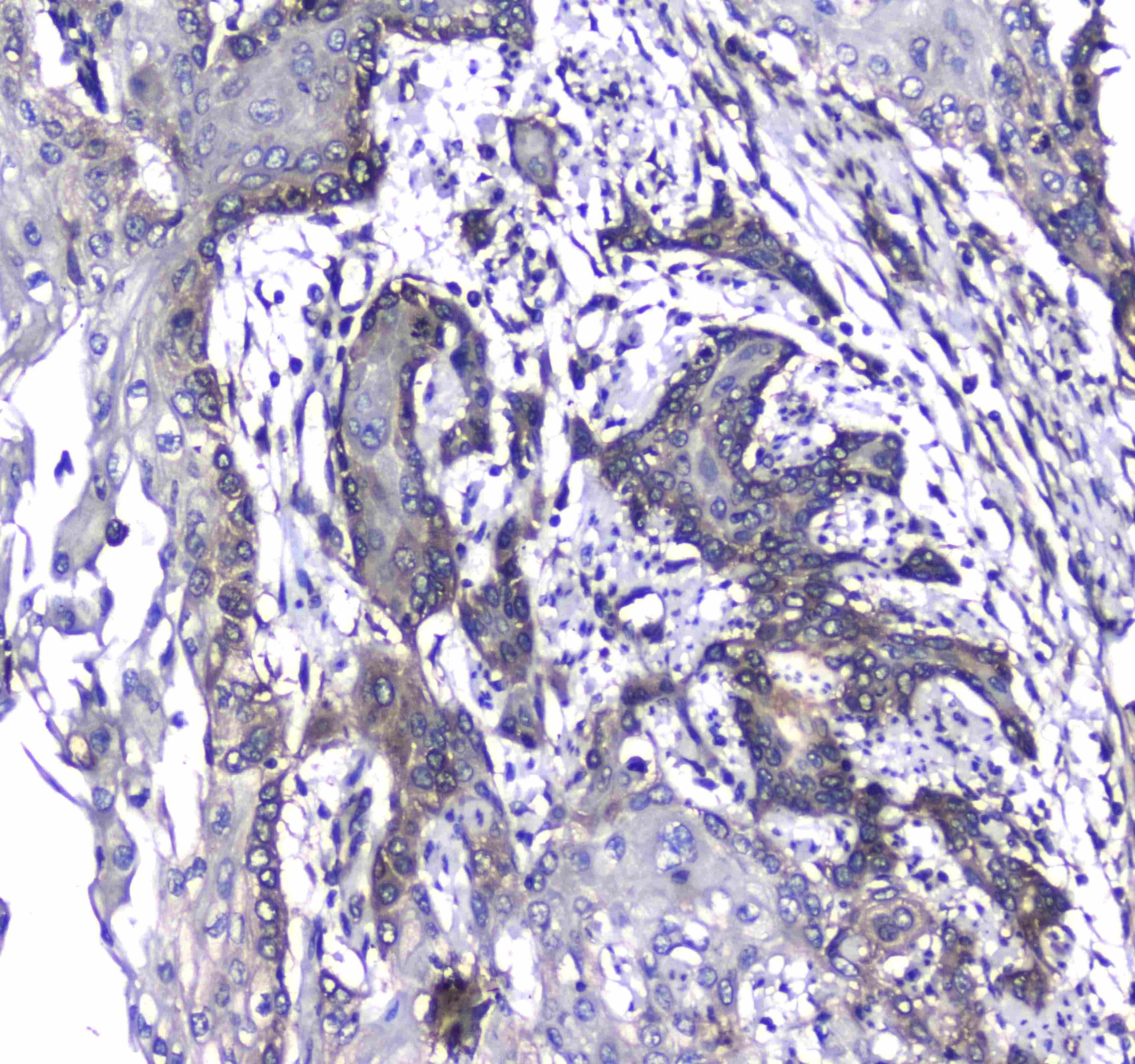 CD171 (L1CAM) Antibody (PA5-79573)