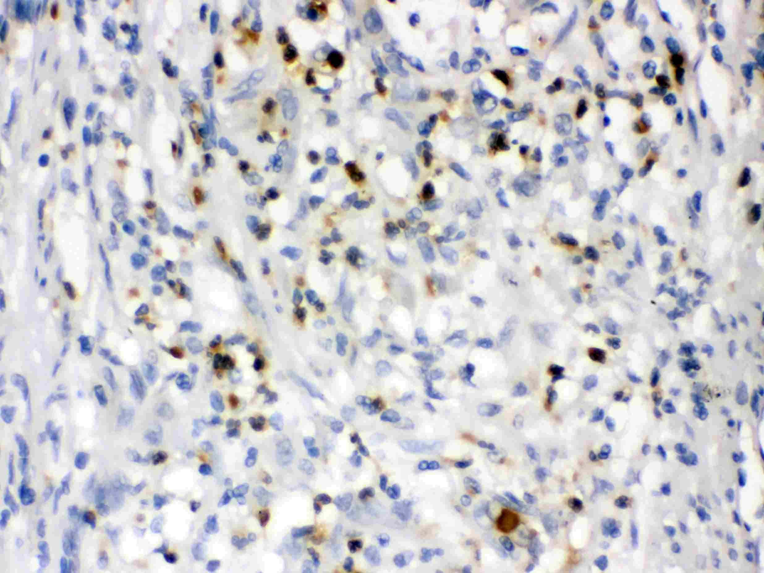 Ngal Antibody (pa5-79589)