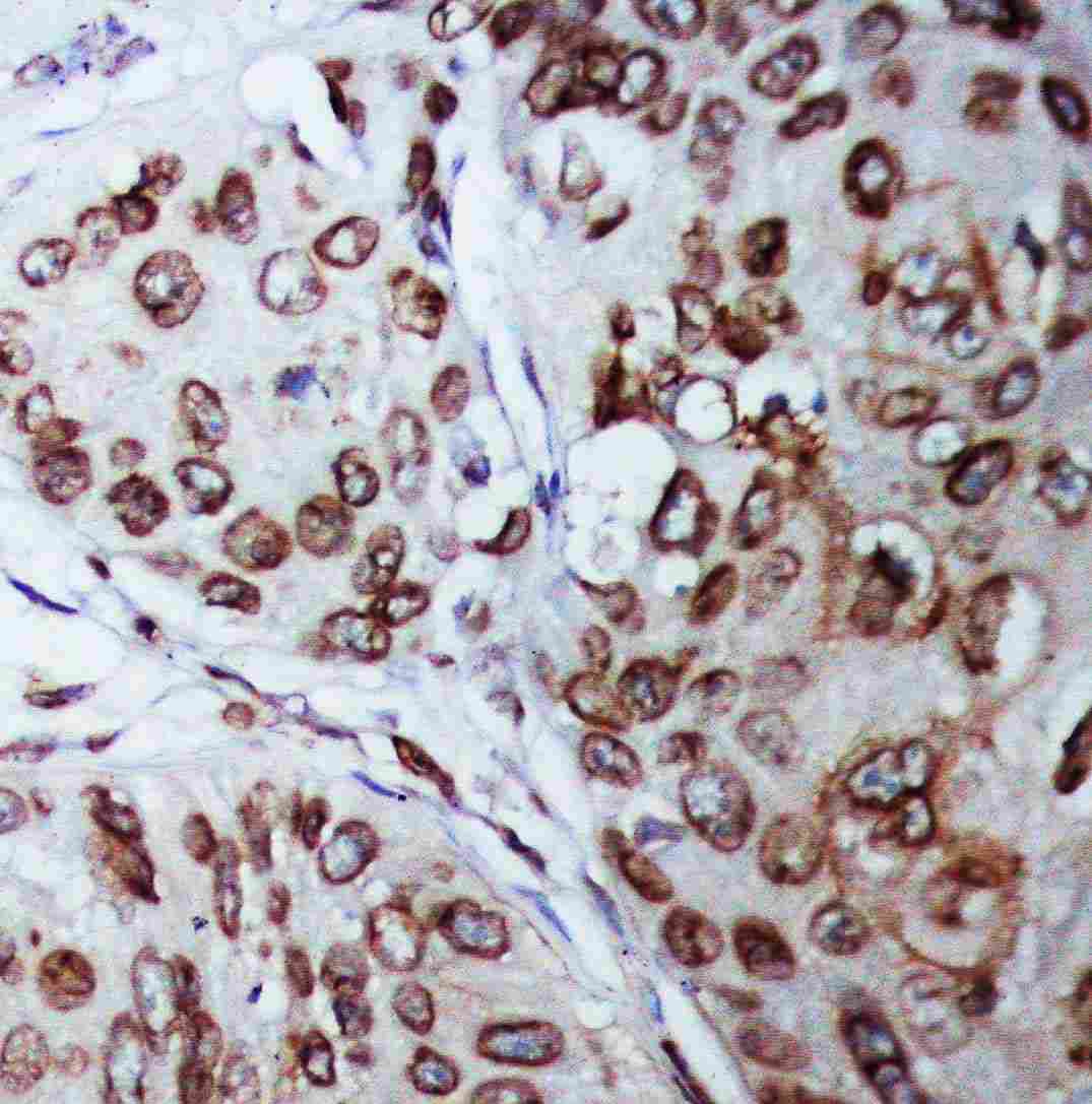 lamin b1 antibody pa5 79606 lamin b1 antibody pa5 79606