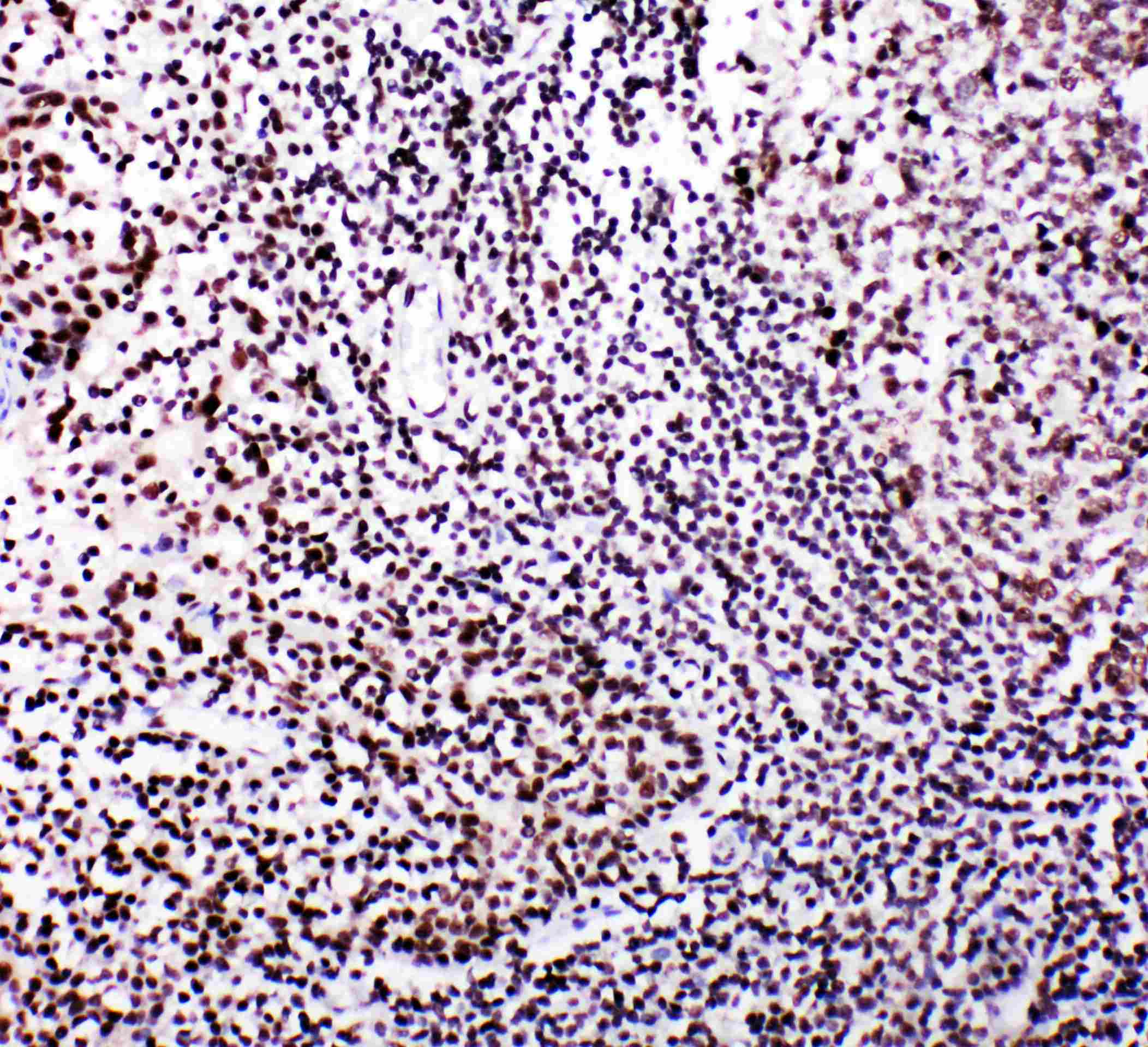 B-Myb Antibody (PA5-79713)