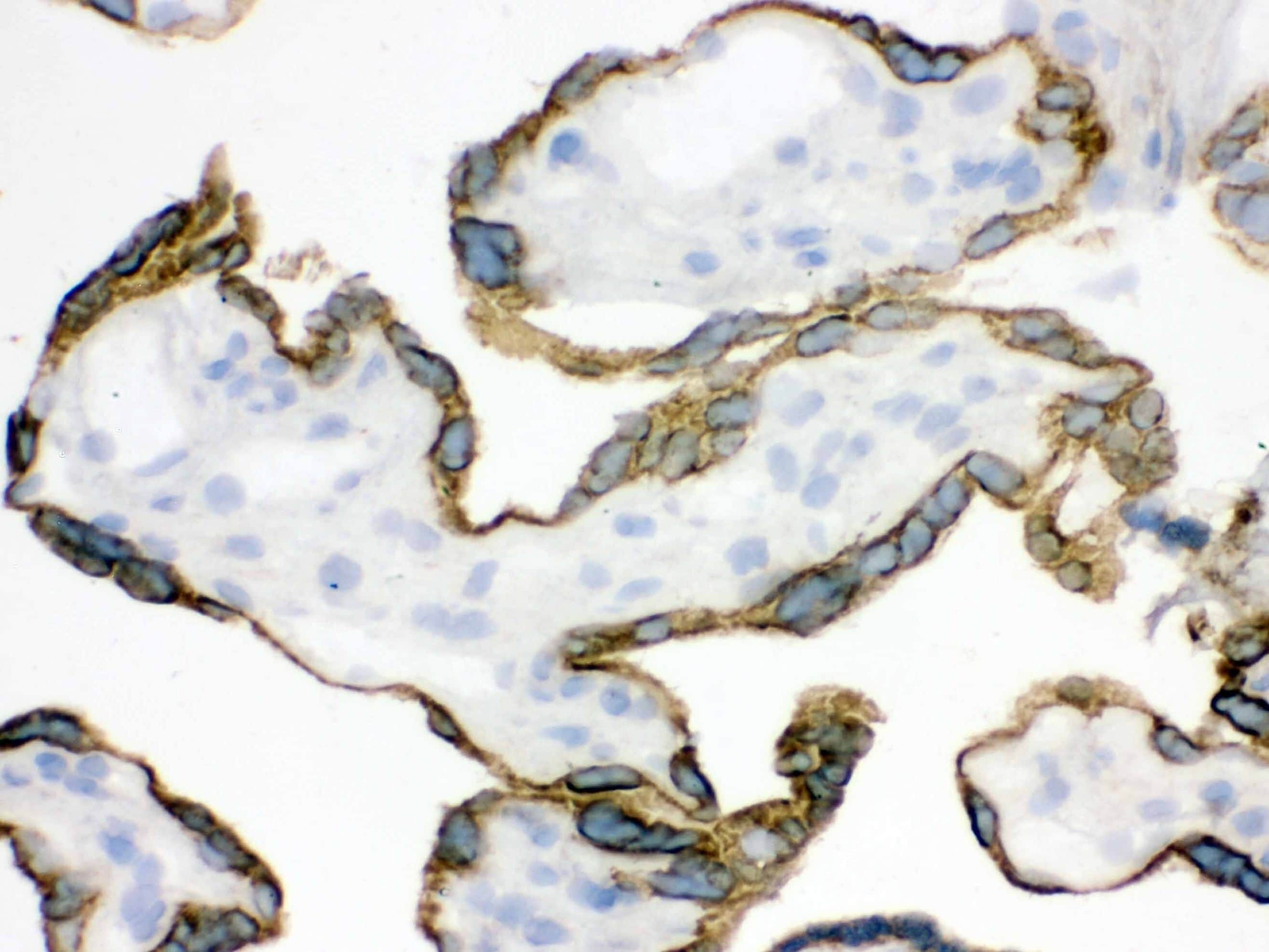 ZP2 Antibody (PA5-80248)