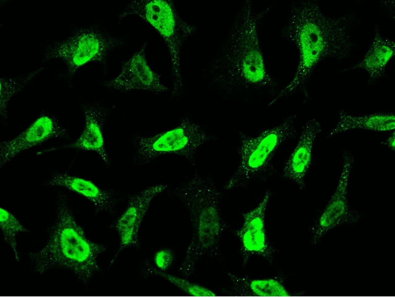 CDK4 Antibody (PA5-80461)