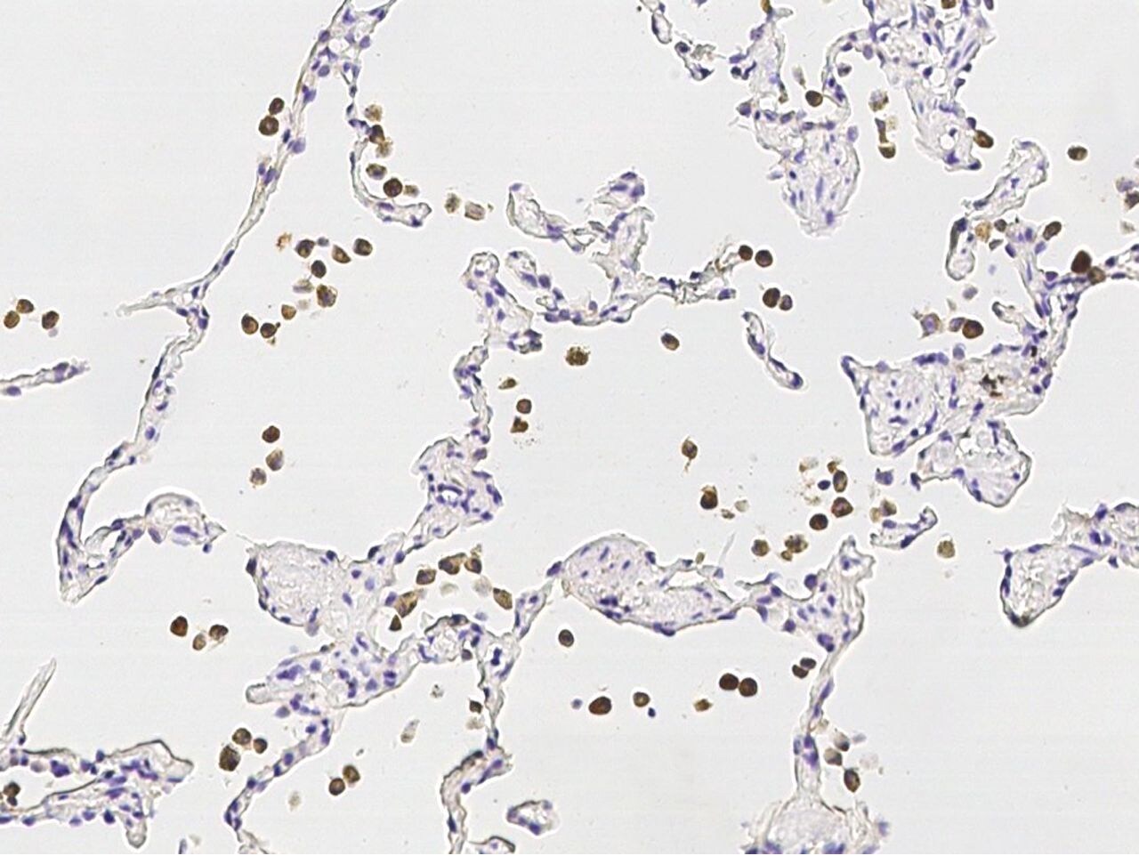 MMP12 Antibody (PA5-80818)