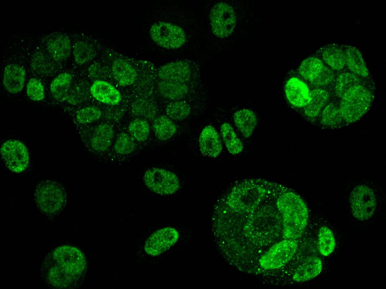 AMPK alpha-2 Antibody (PA5-81303)