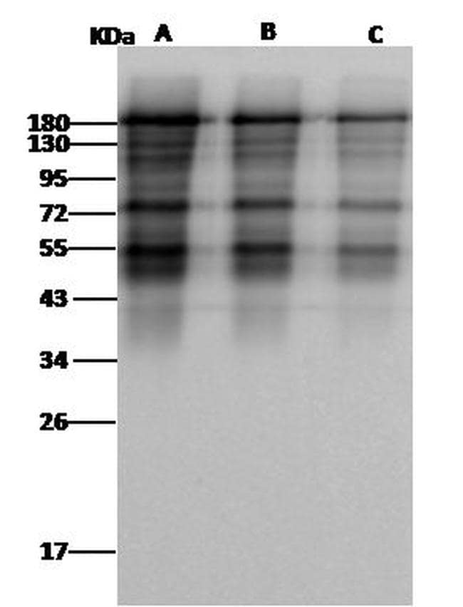 spike protein antibody test