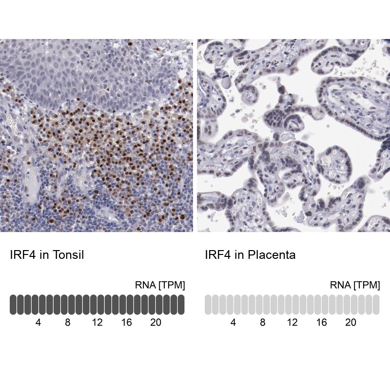 IRF4 Antibody in Immunohistochemistry (IHC)