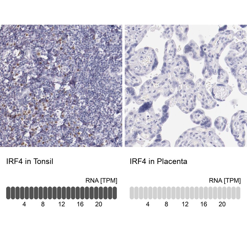 IRF4 Antibody in Immunohistochemistry (IHC)