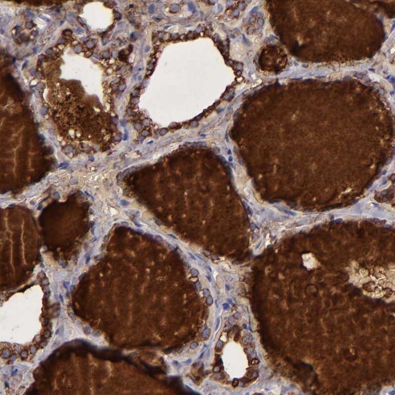 Anti thyroglobulin antibodies invitrogen