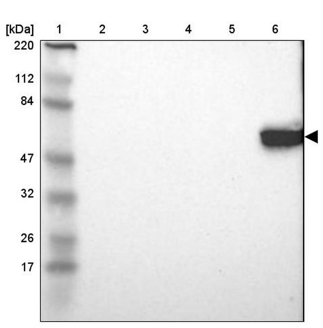 LCK Antibody (PA5-82099)