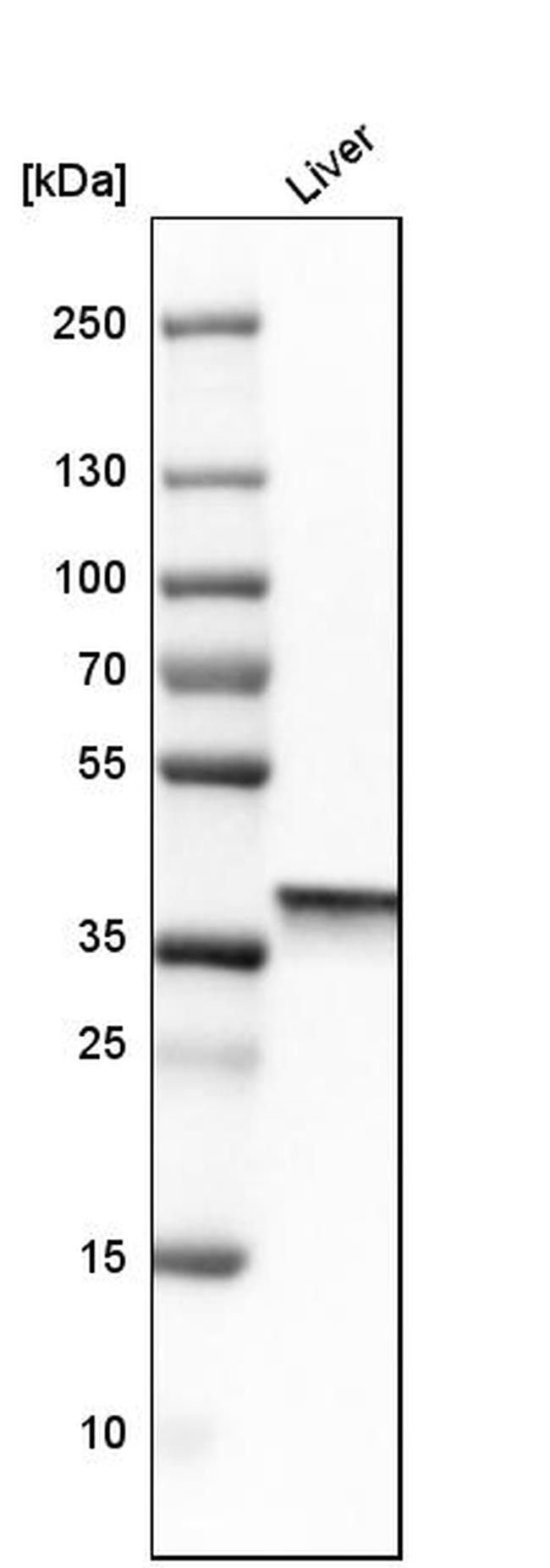 Arginase 1 Antibody (PA5-82106)