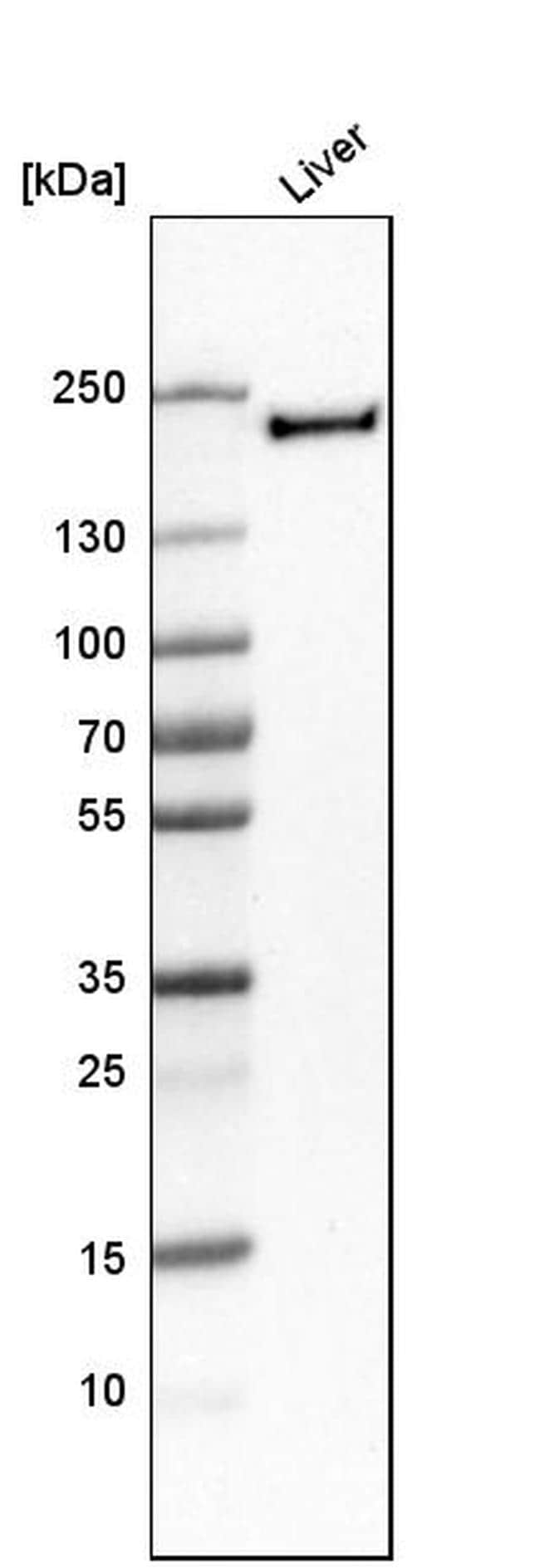 CD206 Antibody in Western Blot (WB)