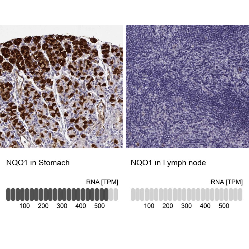 NQO1 Antibody in Immunohistochemistry (IHC)