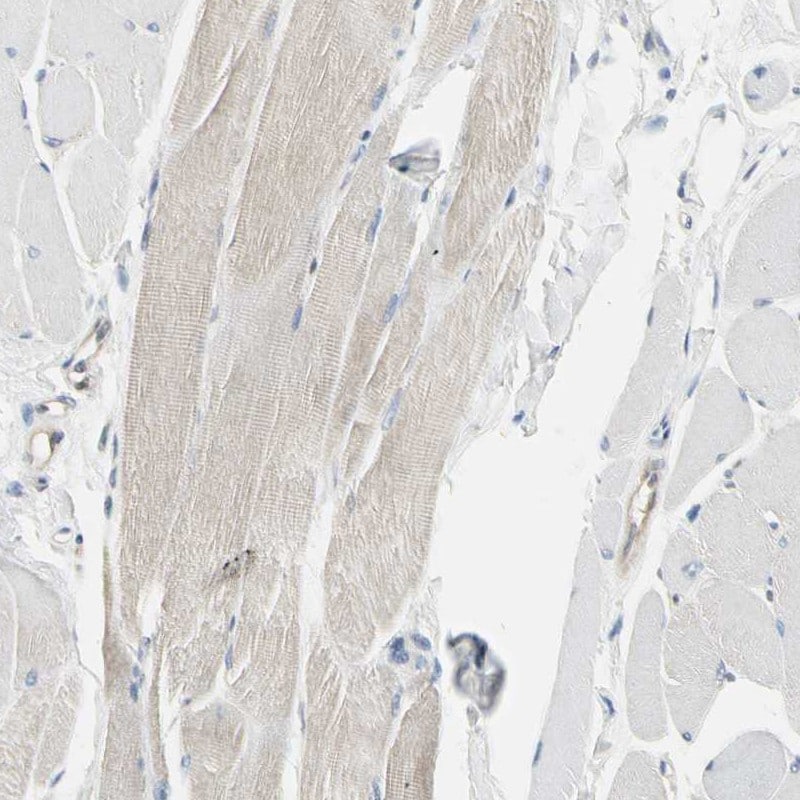 NFkB p52 Antibody (PA5-82349)