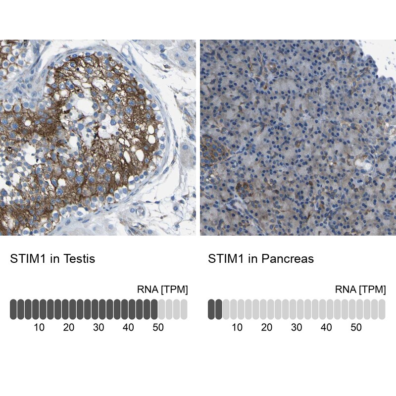 STIM1 Antibody in Immunohistochemistry (IHC)