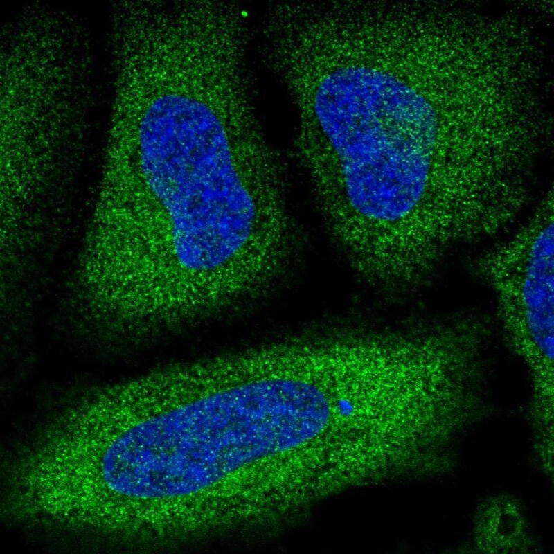 PDE3A Antibody (PA5-82503)