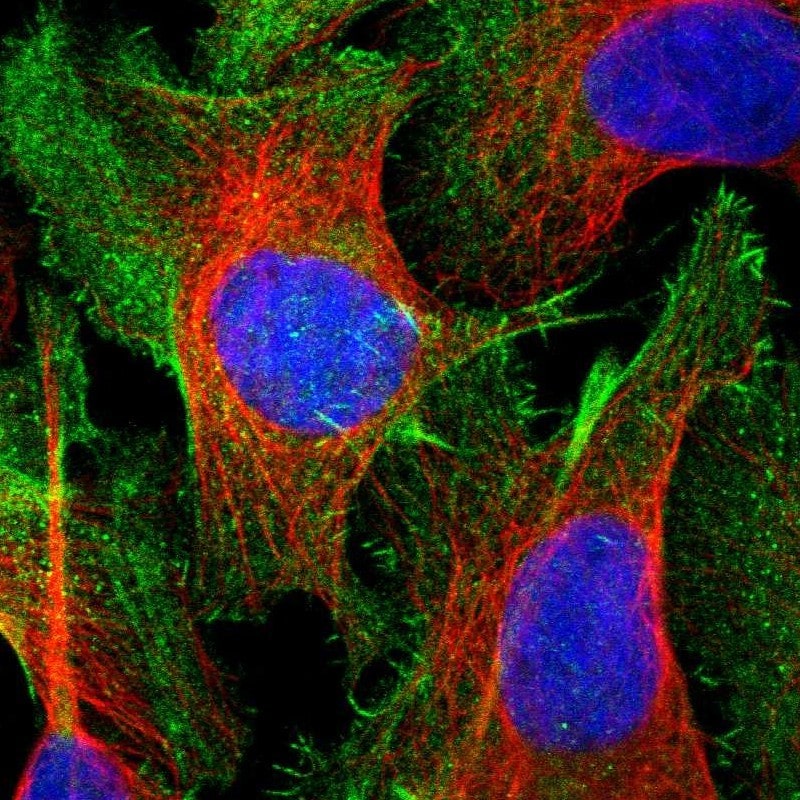 Caldesmon Antibody (PA5-82584)