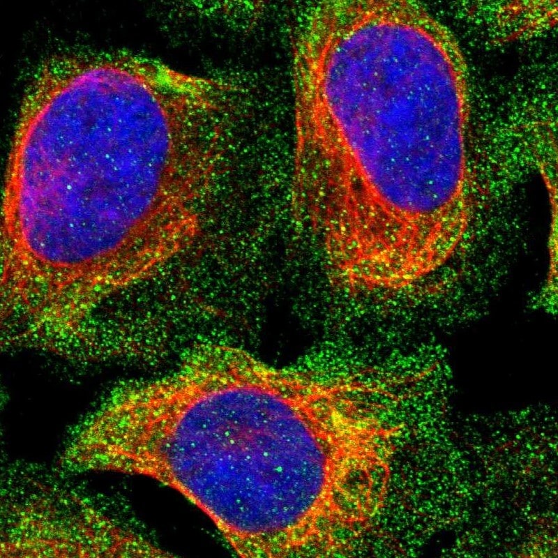 PPP3CC Antibody (PA5-82830)