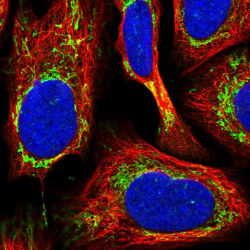 Fumarase Antibody (PA5-82899)