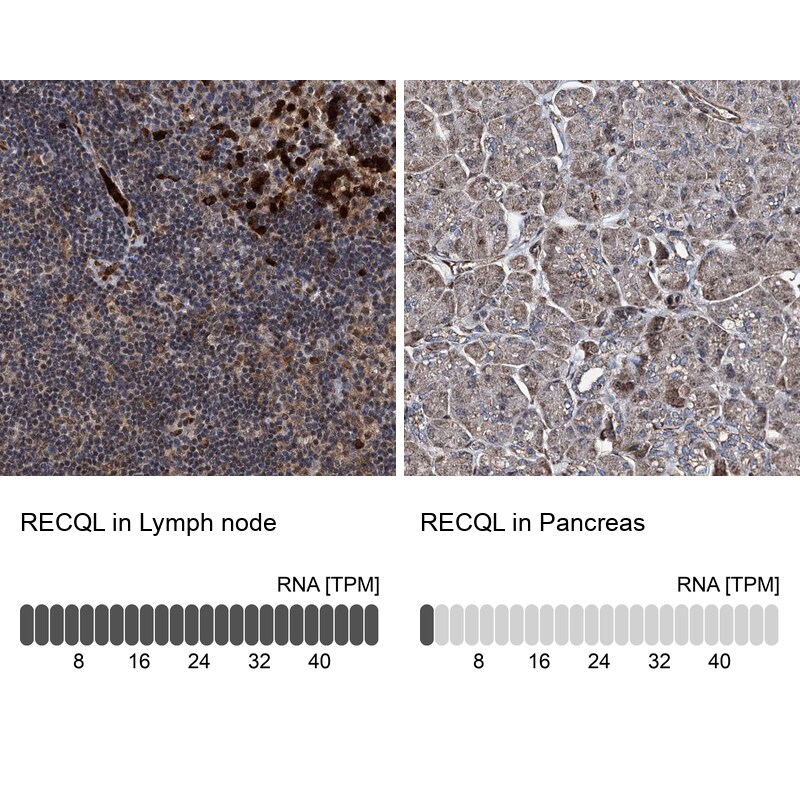 RECQ1 Antibody in Immunohistochemistry (IHC)