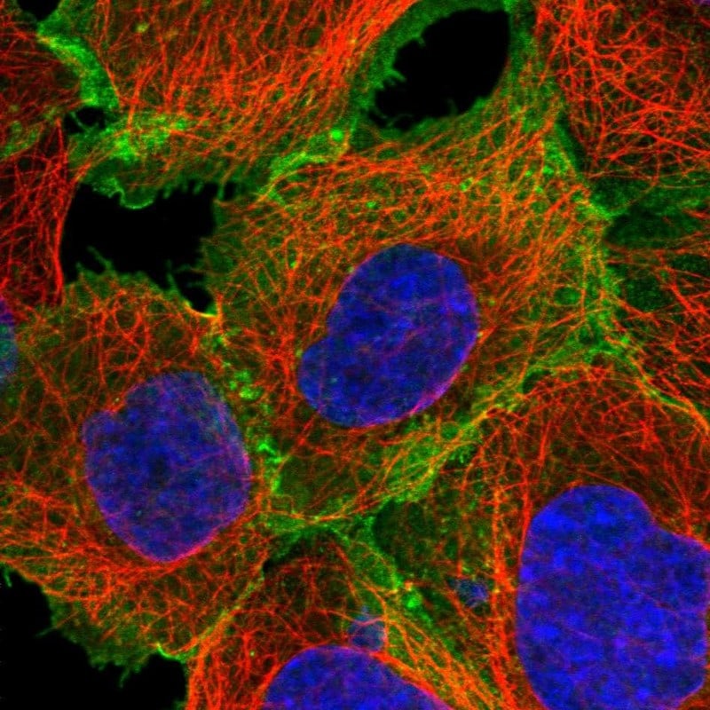 ASCT2 Antibody (PA5-83265)