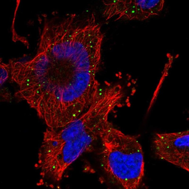 HFM1 Antibody (PA5-83278)
