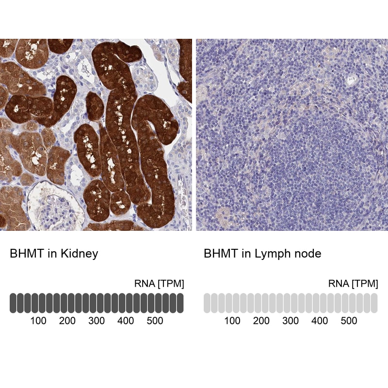BHMT Antibody in Immunohistochemistry (IHC)