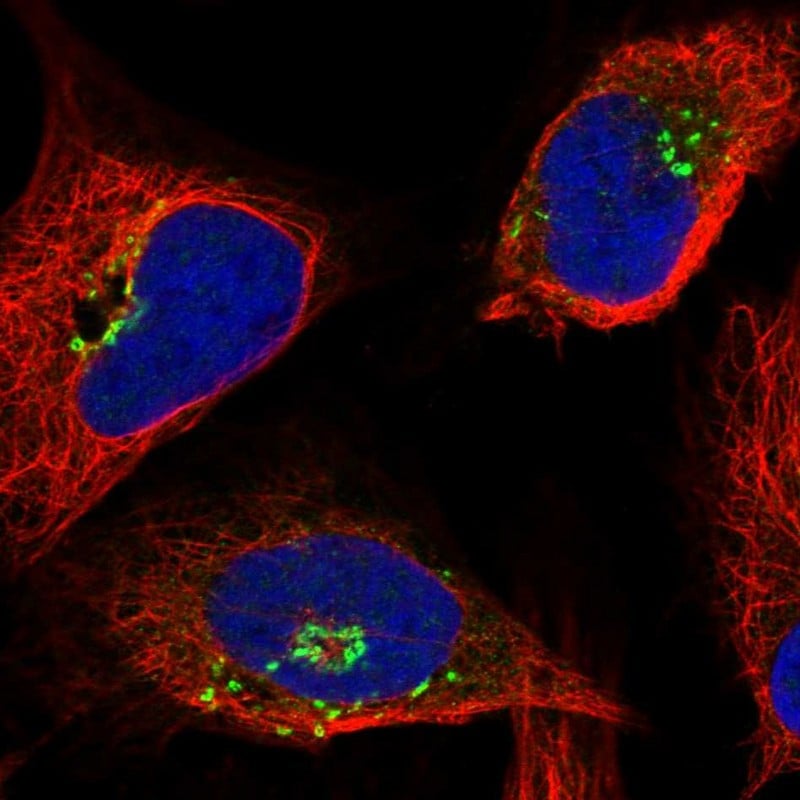 OSBP Antibody (PA5-83452)