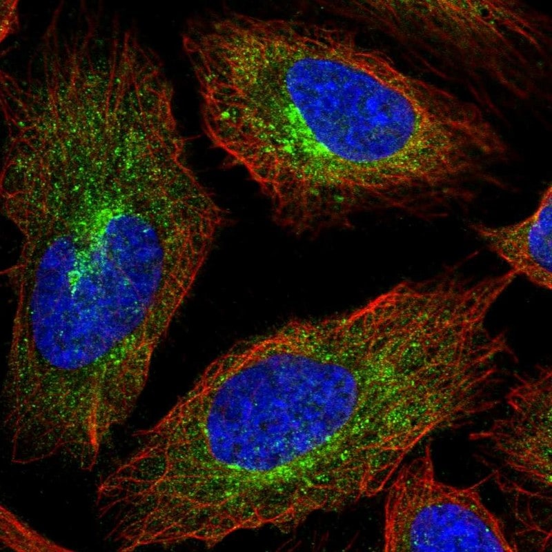 APC1 Antibody (PA5-83639)