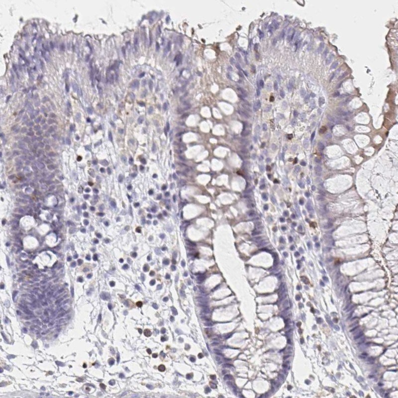 PIK3CD Antibody (PA5-83748)