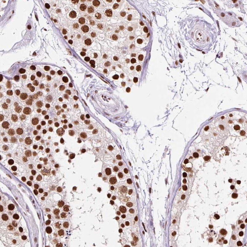 Ku70 Antibody (PA5-83871)