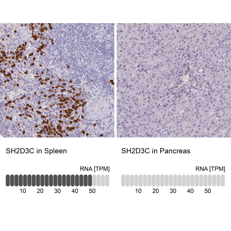 SH2D3C Antibody in Immunohistochemistry (IHC)