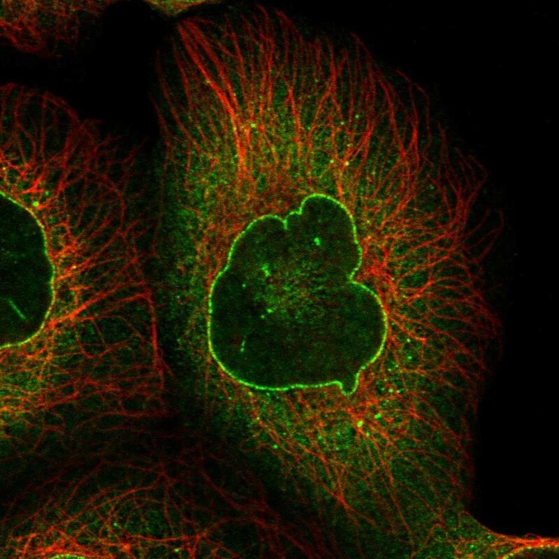 RANGAP1 Antibody (PA5-83992)