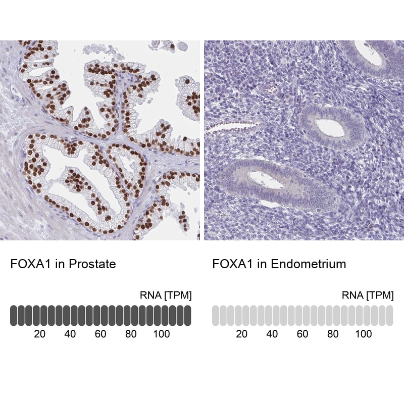FOXA1 Antibody in Immunohistochemistry (IHC)