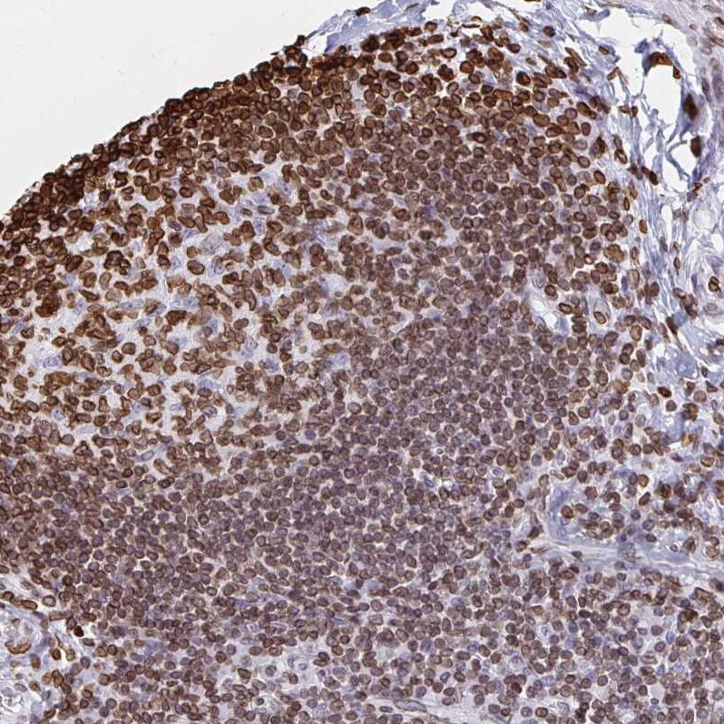 lamin b1 antibody pa5 84009 lamin b1 antibody pa5 84009
