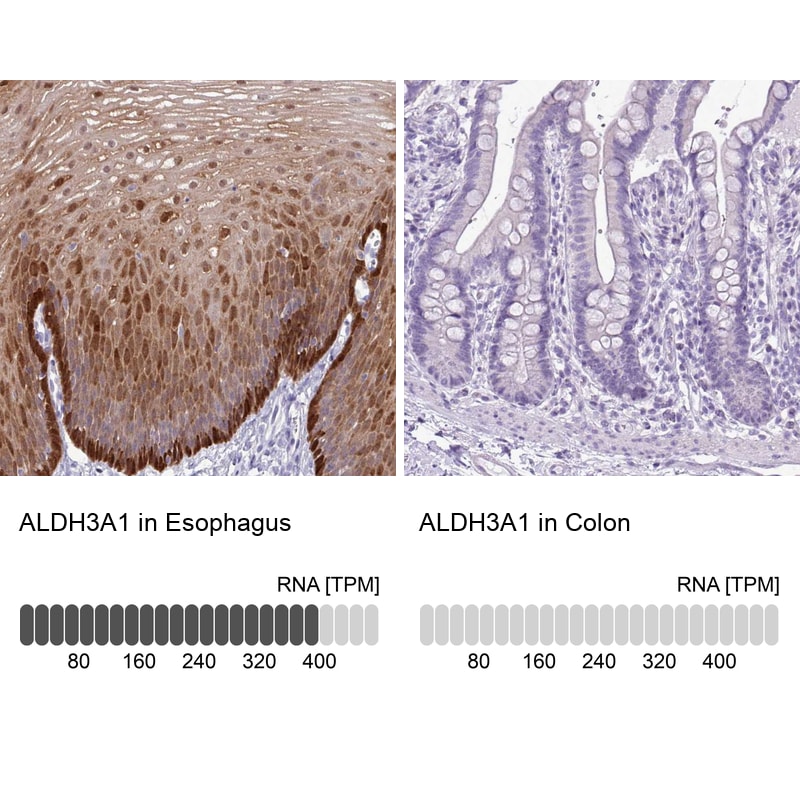 ALDH3A1 Antibody