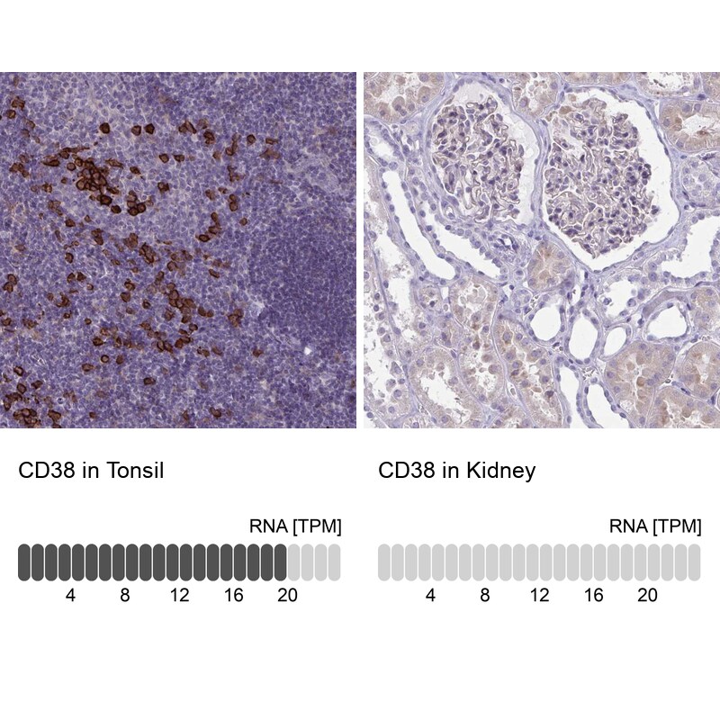 CD38 Antibody in Immunohistochemistry (IHC)