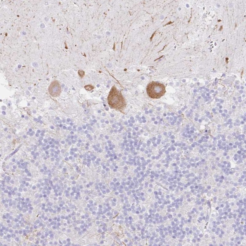 DKK4 Antibody (PA5-84130)