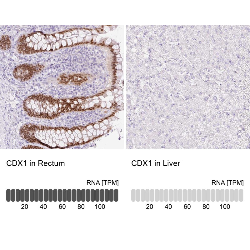 CDX1 Antibody in Immunohistochemistry (IHC)