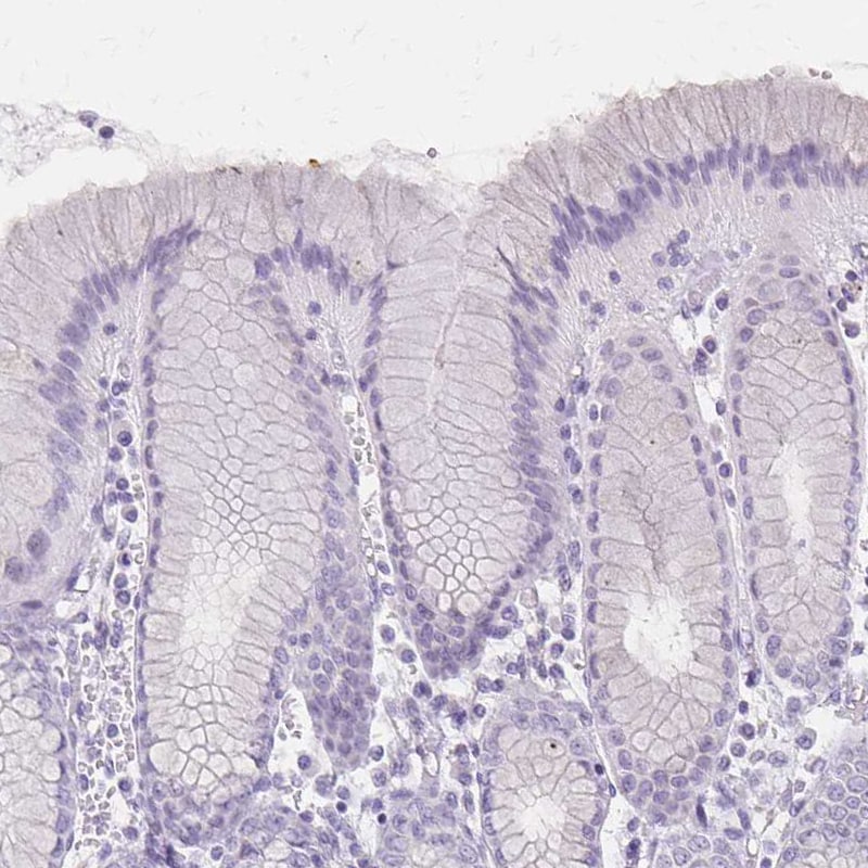 Involucrin Antibody (pa5-84245)