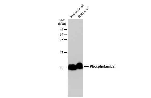 Phospholamban Antibody Pa5 85268