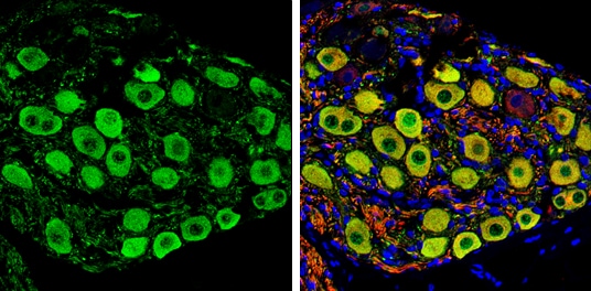 PGP9.5 Antibody (PA5-85273)