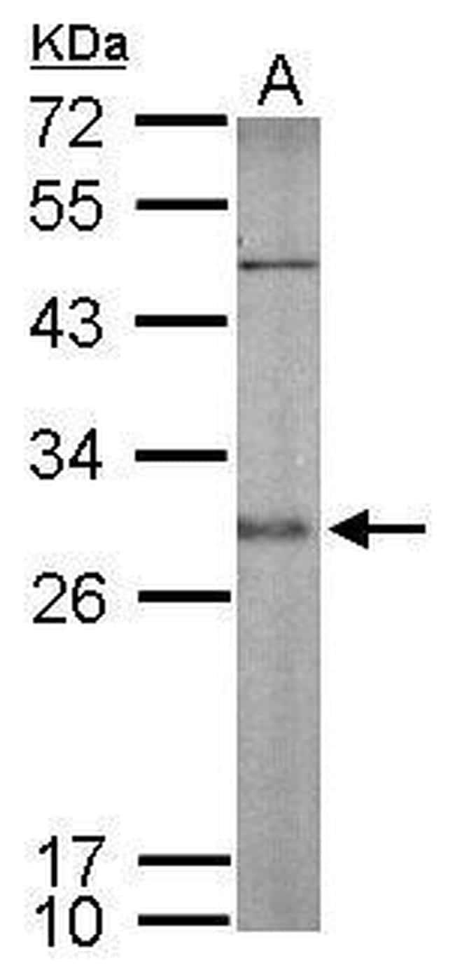 SNAP25 Antibody in Western Blot (WB)