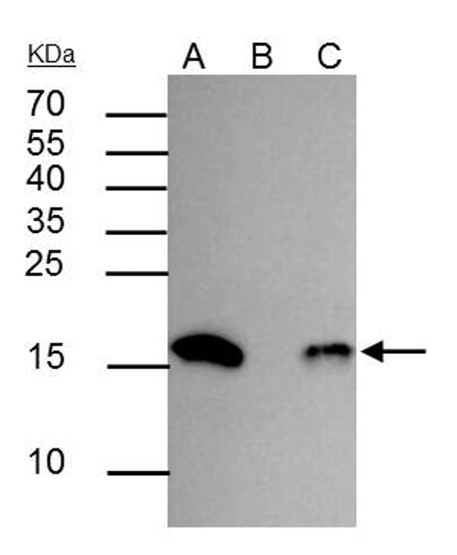 H3K18ac Antibody in Immunoprecipitation (IP)