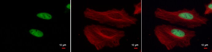 H3k4me3 Antibody Pa5 85525